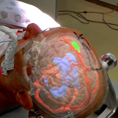 Project 9600 Background