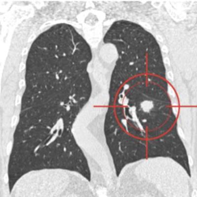 Publication 2491 Background