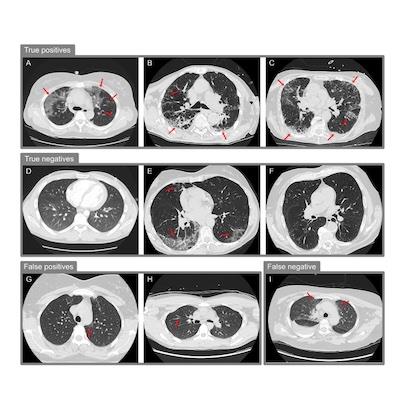 Publication 662 Background